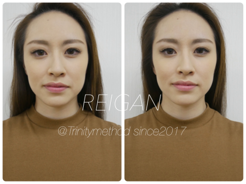 戻顔セルフケアメソッドビフォー&アフター