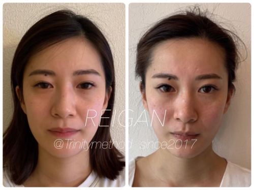 戻顔セルフケアメソッドビフォー&アフター